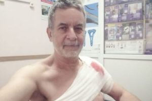 Corresponsal chileno Alejandro Kirk resultó herido por ráfagas de metralla en Ucrania